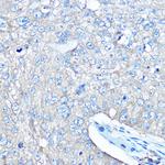 Seryl-tRNA synthetase Antibody in Immunohistochemistry (Paraffin) (IHC (P))