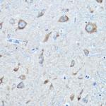 Seryl-tRNA synthetase Antibody in Immunohistochemistry (Paraffin) (IHC (P))