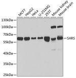 Seryl-tRNA synthetase Antibody in Western Blot (WB)