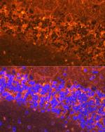 alpha Synuclein Antibody in Immunohistochemistry (Paraffin) (IHC (P))