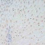 TCEB2 Antibody in Immunohistochemistry (Paraffin) (IHC (P))