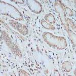 TCEB2 Antibody in Immunohistochemistry (Paraffin) (IHC (P))