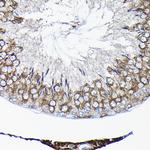 TCP1 Antibody in Immunohistochemistry (Paraffin) (IHC (P))