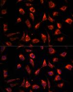 TPT1 Antibody in Immunocytochemistry (ICC/IF)