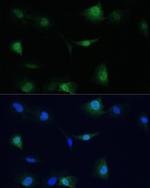 VCP Antibody in Immunocytochemistry (ICC/IF)