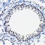 SSNA1 Antibody in Immunohistochemistry (Paraffin) (IHC (P))