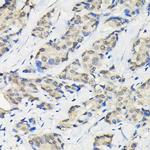 SSNA1 Antibody in Immunohistochemistry (Paraffin) (IHC (P))