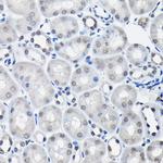 SSNA1 Antibody in Immunohistochemistry (Paraffin) (IHC (P))