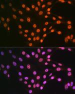 TDP-43 Antibody in Immunocytochemistry (ICC/IF)