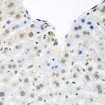 TDP-43 Antibody in Immunohistochemistry (Paraffin) (IHC (P))