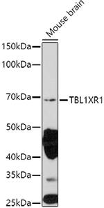 TBLR1 Antibody in Western Blot (WB)