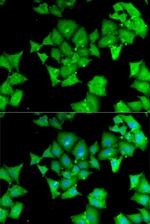 Aminoacylase Antibody in Immunocytochemistry (ICC/IF)