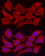 ADH5 Antibody in Immunocytochemistry (ICC/IF)