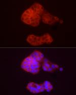 ADH5 Antibody in Immunocytochemistry (ICC/IF)