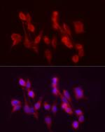 ADH5 Antibody in Immunocytochemistry (ICC/IF)