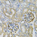 Adenylate Kinase 1 Antibody in Immunohistochemistry (Paraffin) (IHC (P))