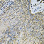 Adenylate Kinase 1 Antibody in Immunohistochemistry (Paraffin) (IHC (P))