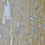 Adenylate Kinase 1 Antibody in Immunohistochemistry (Paraffin) (IHC (P))