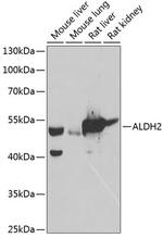 ALDH2 Antibody in Western Blot (WB)