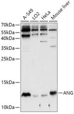 Angiogenin Antibody in Western Blot (WB)