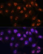 Fibrillarin Antibody in Immunocytochemistry (ICC/IF)