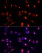 Fibrillarin Antibody in Immunocytochemistry (ICC/IF)