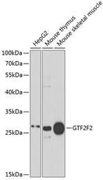 GTF2F2 Antibody in Western Blot (WB)