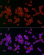 Lysozyme Antibody in Immunocytochemistry (ICC/IF)