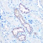 Lysozyme Antibody in Immunohistochemistry (Paraffin) (IHC (P))