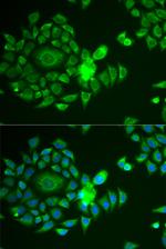 NDUFS4 Antibody in Immunocytochemistry (ICC/IF)