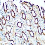 NDUFS4 Antibody in Immunohistochemistry (Paraffin) (IHC (P))