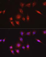 COL1A1 Antibody in Immunocytochemistry (ICC/IF)