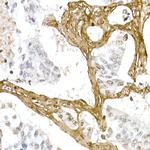 COL1A1 Antibody in Immunohistochemistry (Paraffin) (IHC (P))