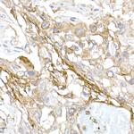 COL1A1 Antibody in Immunohistochemistry (Paraffin) (IHC (P))