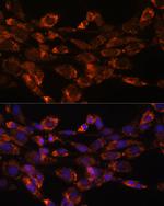 MAOA Antibody in Immunocytochemistry (ICC/IF)