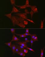 TFAM Antibody in Immunocytochemistry (ICC/IF)