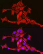 TFAM Antibody in Immunocytochemistry (ICC/IF)