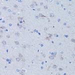 TFAM Antibody in Immunohistochemistry (Paraffin) (IHC (P))