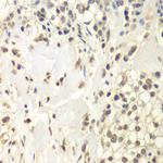 USP7 Antibody in Immunohistochemistry (Paraffin) (IHC (P))