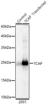 TCAP Antibody in Western Blot (WB)