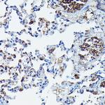 APOBEC3G Antibody in Immunohistochemistry (Paraffin) (IHC (P))