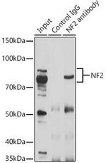 NF2 Antibody in Immunoprecipitation (IP)