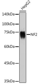 NF2 Antibody in Western Blot (WB)