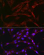 PKC beta Antibody in Immunocytochemistry (ICC/IF)