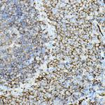 PKC beta Antibody in Immunohistochemistry (Paraffin) (IHC (P))