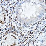 PKC beta Antibody in Immunohistochemistry (Paraffin) (IHC (P))