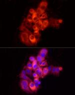 Albumin Antibody in Immunocytochemistry (ICC/IF)