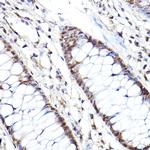 PSMB2 Antibody in Immunohistochemistry (Paraffin) (IHC (P))