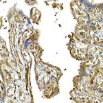 MDA5 Antibody in Immunohistochemistry (Paraffin) (IHC (P))