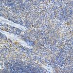 MDA5 Antibody in Immunohistochemistry (Paraffin) (IHC (P))